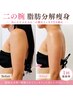 【結果重視】二のうで脂肪分解痩身◆ぷるぷる二の腕卒業!ノースリーブに自信