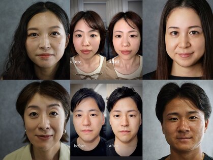 ジプソ(GYPSO)の写真