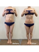 きれい塾 恵比寿/40代一回施術後