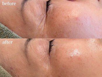 リボーン 浜松(reborn)/