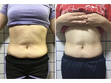 アリス フィットネスサロン/＊施術効果＊