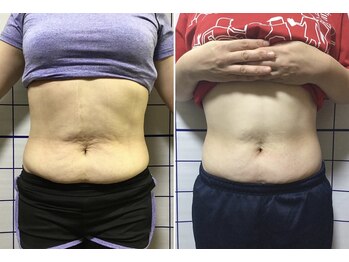 アリス フィットネスサロン/*施術効果*