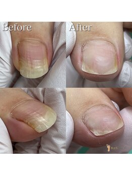 巻き爪補正店 横浜駅前店/