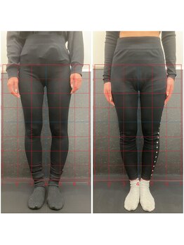 W2 馬車道/O脚改善ビフォーアフター♪