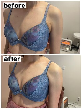 マイントゥー(mine too)/