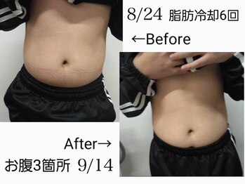 スリム(SLIM by lily of the valley)/硬いお肉にはコースがおすすめ