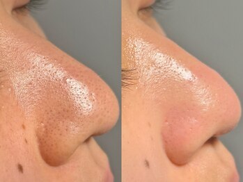 ルーナジェーナ(Luna llena)/