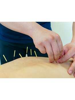 鍼灸施術を受けたい