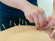 アキュピタル(acupital)の写真/【女性のなんとなく不調に特化した鍼灸院】丁寧なカウンセリングとお悩みに寄り添う施術で心身の不調を改善