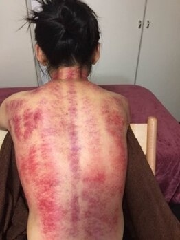 優勝リラ!!/任せコースカッサマッサージ