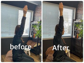 クラーレ(CURARE)