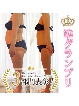 エステティックサロン リノリノ(Lino Lino)の写真/ダイエット準グランプリ受賞☆スリムになりたいあなたへ!6種のメニューで理想のボディラインへ導きます♪