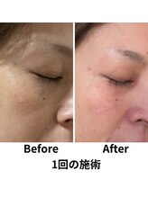 リンパケアルーム ヘンプ(hemp)/今話題のホワイトラボ♪