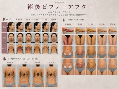 ソワベル(SoieBelle)の写真