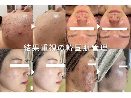 ルネル(Lunelle)の写真