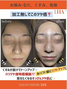 サロン 稲(SALON IIIINEE)/ララピール