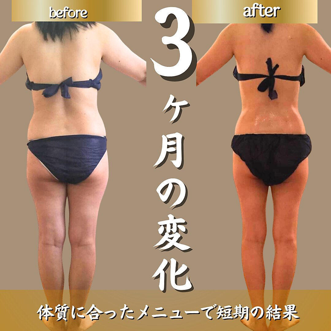 【大幅値下げ】リファインシュール 痩身エステ 大幅値下げ】リファインシュール 痩身エステ 第25回美脚部門2位 天神店