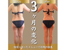 エステティック ジェミー(ESTHTETIQUE Gemmy)
