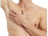 【メンズ脱毛】両ワキ脱毛< 痛みが少なくお肌に優しい♪>