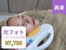 【男女】【シワ＆たるみ予防☆肌質改善】光フェイシャル￥7,700