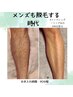 【men's】シュガーリング脱毛　両足ALL　1回　¥18.000