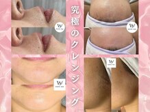 ホワイトワックス つくば店(WHITE WAX)/