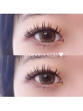 キラナ(kiranah)/＊バインドロック120束フル