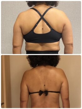 ベルソー(Berceau)/痩身コース