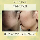 リレア ラカ(Relair Laka)