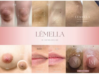 ピュアソル(Puresol)の写真
