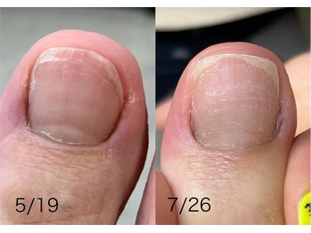 ロンディネ(Rondine)/フットケア02