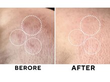 ゼロ 水戸店(ZERO)/ダクトピール