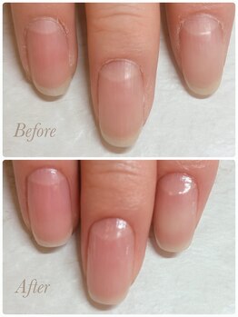 ソワン(soin)/当日ビフォーアフター