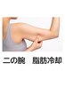 【大人気】振袖のお悩みに!二の腕の脂肪冷却 ¥13,200