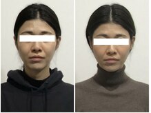 シンメトリー 麻布十番/Before/After