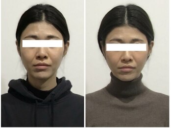 シンメトリー 麻布十番/Before/After