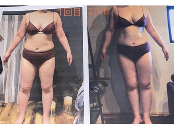 エスデザイン(es design)/リンパマッサージ/痩身/鹿児島