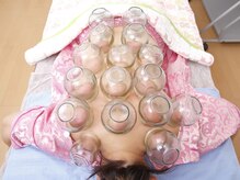 ファミリア602/カッピング