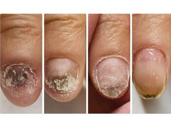 ヴェールリム(verl lim)/