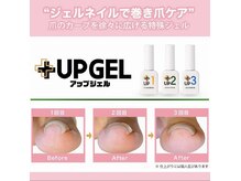 痛く無い巻き爪ケア。韓国で特許を取得してる巻き爪専用ジェル。