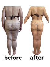 ウィズルーチェ つくばみどりの店(with luce)/衝撃のbefore/after 50代