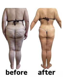 ウィズルーチェ つくばみどりの店(with luce)/衝撃のbefore/after 50代