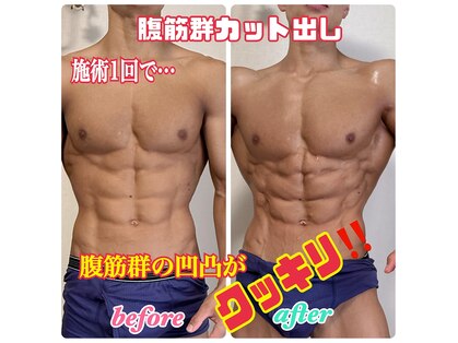 ルミネ(Lumine)の写真