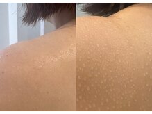 香嬉琉/爆汗◯ビフォー＆アフター