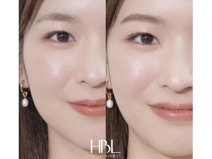 トリコ(trico)の写真