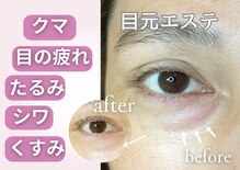 アンジープラス(ANZY+)