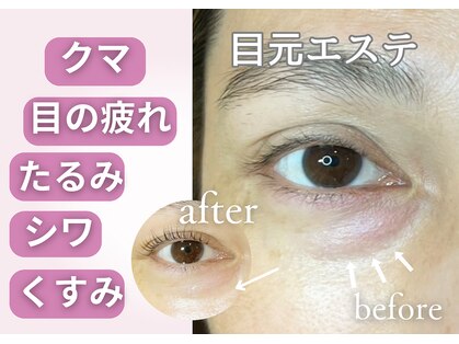 アンジープラス(ANZY+)の写真