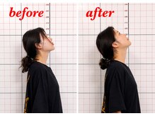 プーラビタ(PURAVITA)/首こり可動域改善 before after