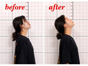 プーラビタ(PURAVITA)/首こり可動域改善 before after