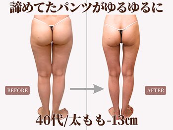 ベモーレ 谷町九丁目 上本町の写真/【施術後に効果実感◎】ヒップアップで全身若見え体験☆ムッチリ太ももまとめてケア！